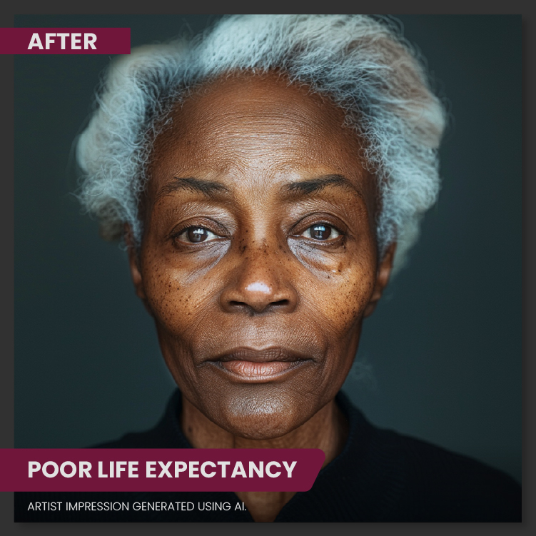 Poor Life Expectancy Skin After