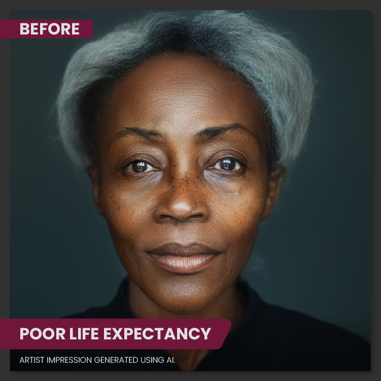 Poor Life Expectancy Skin Before